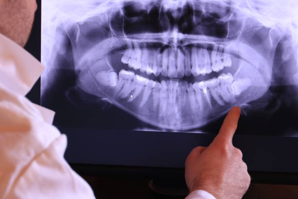 Best After-Hours Dental Trauma Care in Weaverville, NC