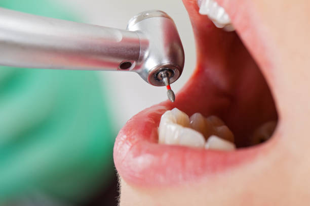 Best Emergency Treatment for Dental Infections or Abscesses in Weaverville, NC